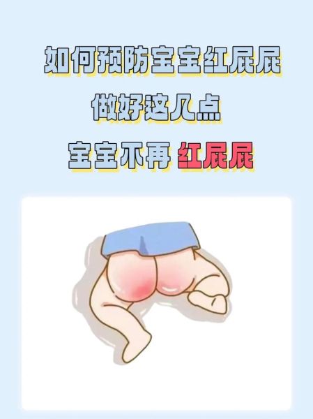 打宝宝屁股有什么危害_宝宝屁股打红了怎么办