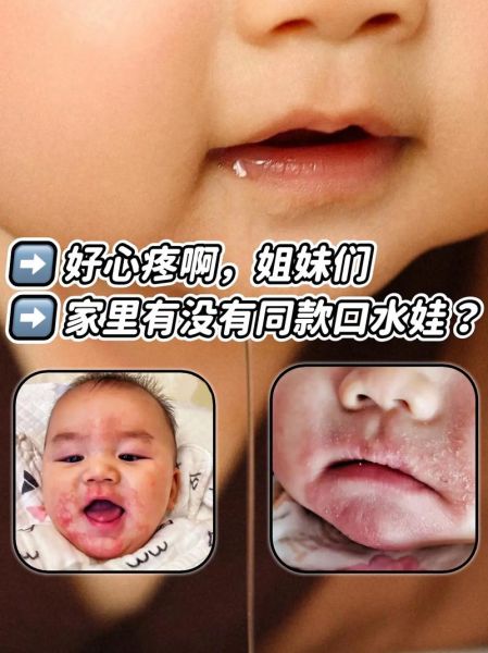 宝宝嘴唇红红的怎么回事_宝宝嘴唇红是上火吗