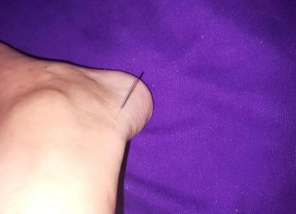 梦到针是什么意思_梦见针扎手好不好