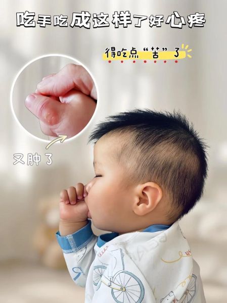 四个月宝宝老是吃手_正常吗