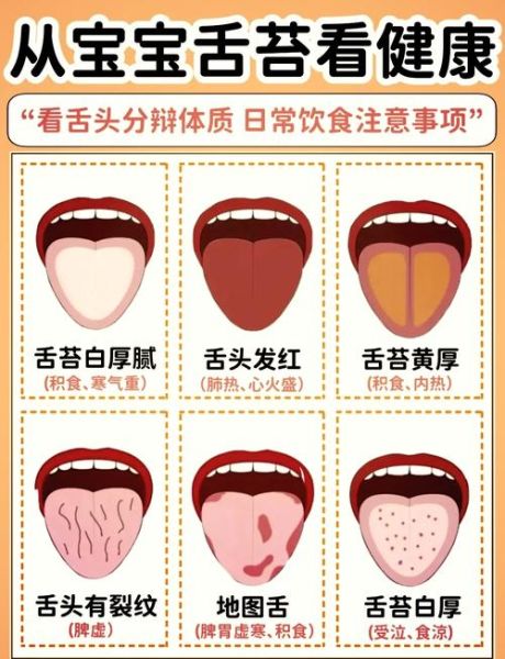 两岁宝宝舌苔厚白是怎么回事_怎么调理