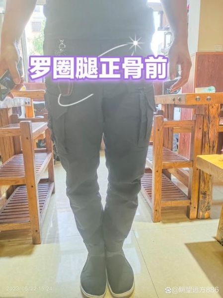 宝宝罗圈腿怎么办_罗圈腿矫正最佳时间