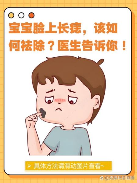 宝宝脸上长黑点怎么办_宝宝脸上黑点会自己消失吗
