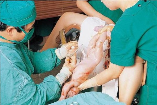 梦到堂弟是什么意思_梦见堂弟代表什么