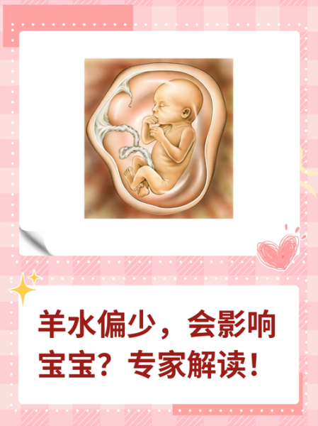 羊水污染对宝宝有什么影响_新生儿吸入污染羊水会怎样