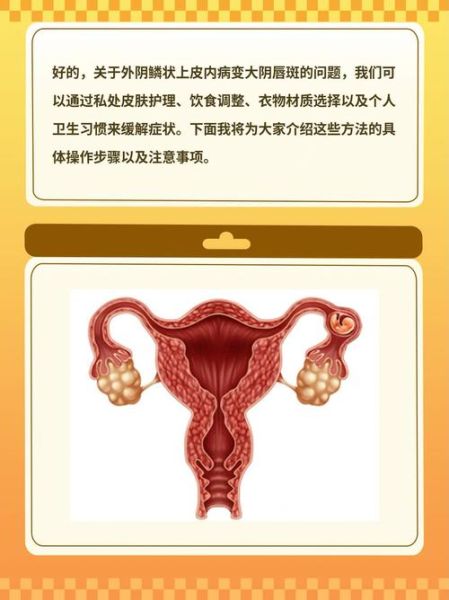 阴道图片大全_阴道正常与异常对比图