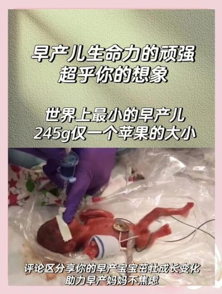 奇迹宝宝真的存在吗_奇迹宝宝成长记录