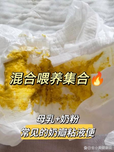 宝宝大便有粘液和奶瓣_正常吗