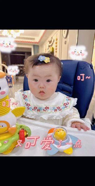 唐氏宝宝能活多久_唐氏宝宝有哪些特征