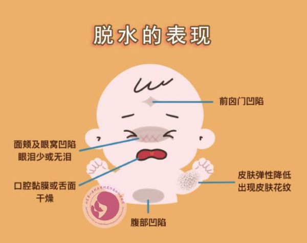 一周岁宝宝拉肚子脱水怎么办_如何判断脱水程度