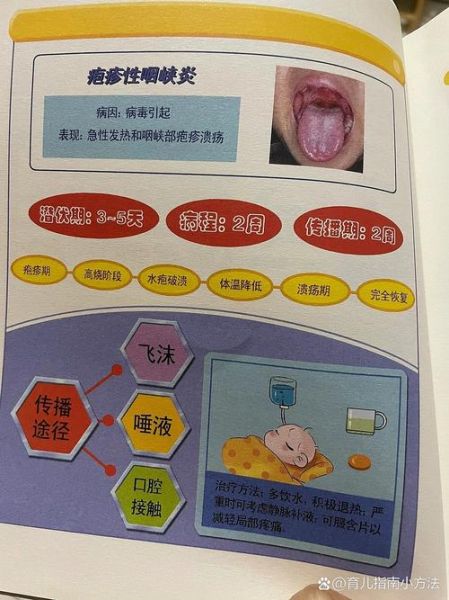 宝宝喉咙有疱疹怎么办_会传染吗