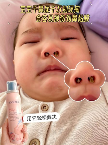 宝宝总是抠鼻子怎么办_宝宝抠鼻子会不会抠坏
