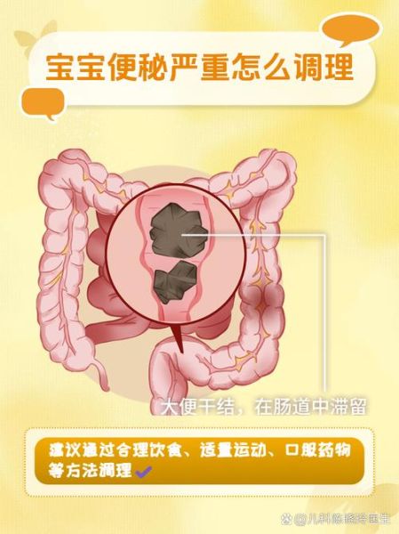 两个月宝宝大便干燥怎么办_宝宝便秘吃什么好