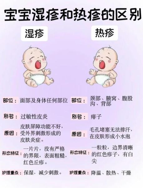 8个月宝宝起疹子怎么办_宝宝反复出疹子如何护理