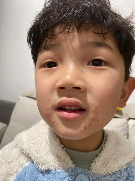 8个月宝宝能吃火龙果吗_火龙果过敏症状