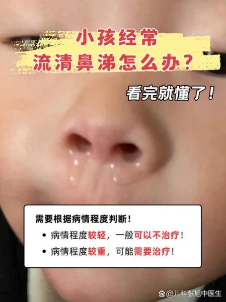 三岁宝宝流鼻涕一个月了怎么办_反复流鼻涕的原因