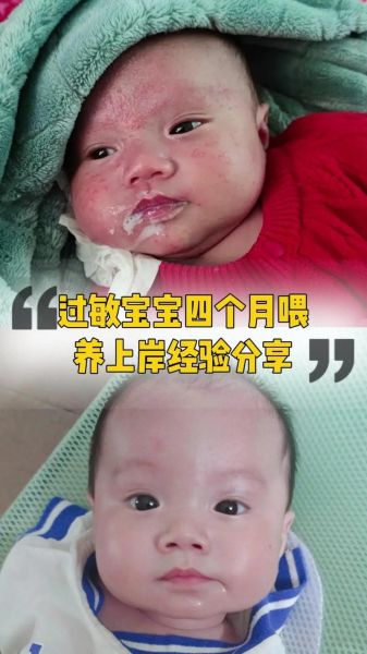 宝宝几个月可以吃蛋清_蛋清过敏怎么办