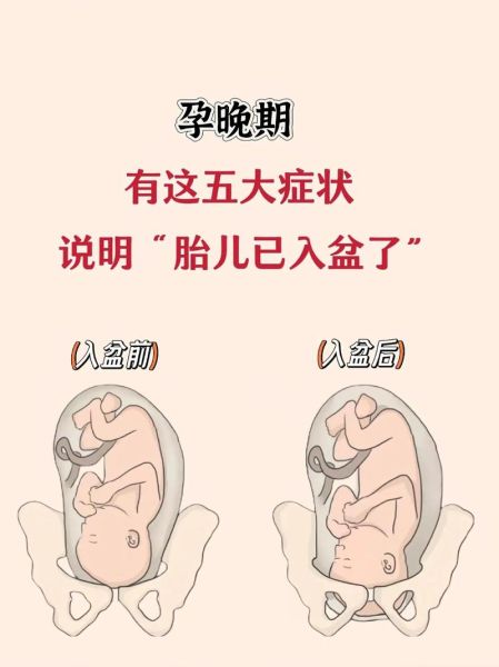 宝宝入盆有什么感觉_入盆后多久会生
