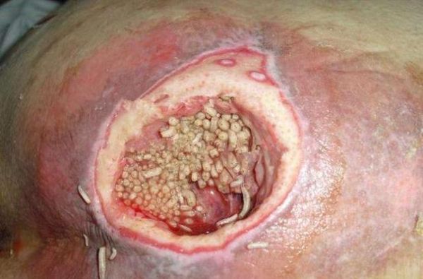 女人梦到蛆虫什么预兆_女人梦见蛆虫是吉是凶