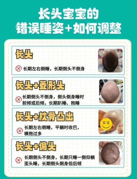 宝宝睡姿会影响头型吗_新生儿仰睡侧睡怎么选