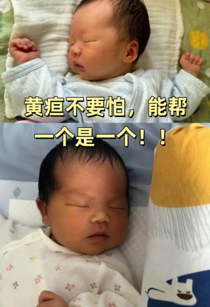 满月宝宝黄疸还没退怎么办_新生儿黄疸持续不退的原因