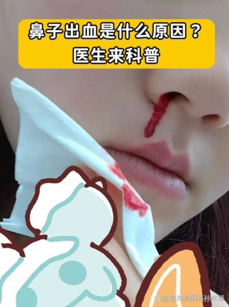 梦到鼻子出血是什么意思_梦到鼻子出血预示什么