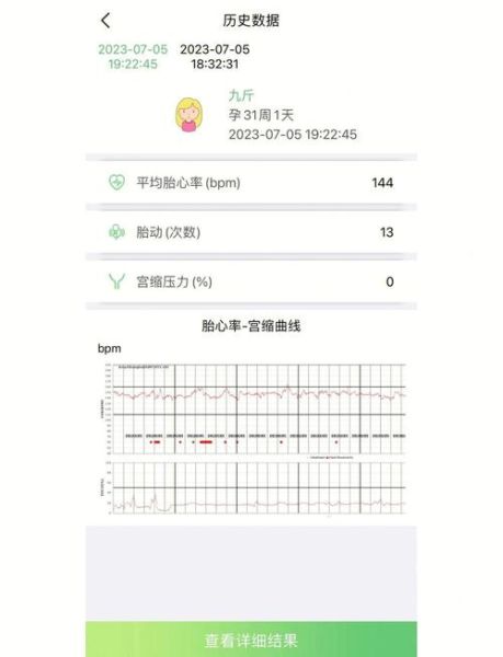 宝宝心率不齐怎么办_宝宝心率不齐正常吗
