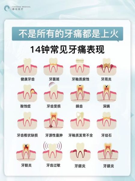 梦到牙疼是怎么回事_梦见牙疼预示什么