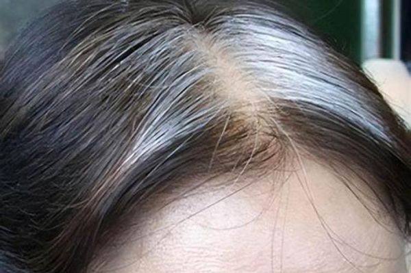 女人梦见自己长白头发_周公解梦准吗