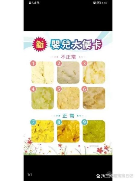 三个月宝宝每天大便几次正常_母乳喂养与奶粉差异