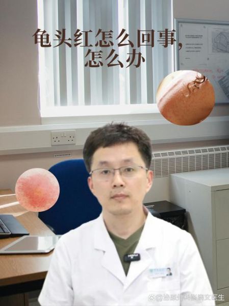 宝宝小鸡头尿道口发红怎么办_婴儿尿道口红肿原因