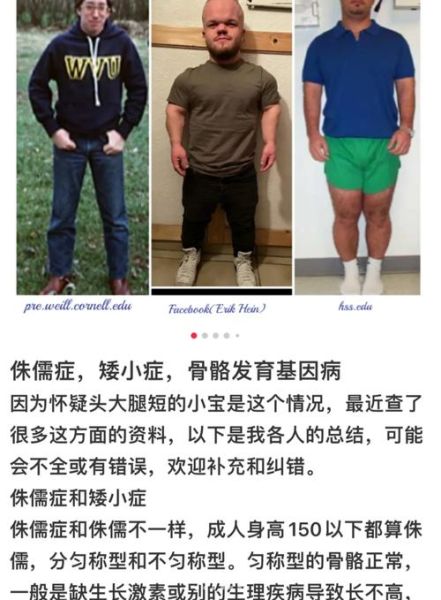 侏儒症宝宝有什么表现_侏儒症宝宝能长高吗