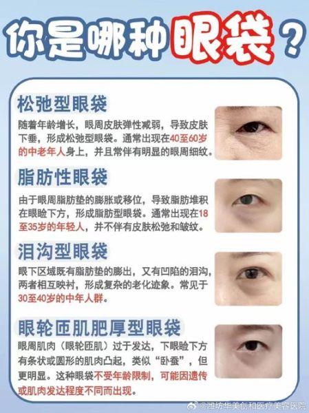 眼袋图片大全_眼袋怎么消除最有效