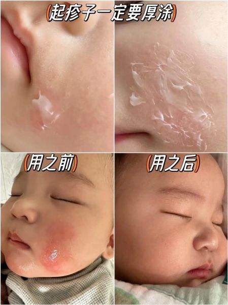 宝宝睡觉流口水是什么原因_宝宝睡觉流口水正常吗