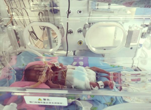 32周早产宝宝多久能出院_32周早产宝宝要住保温箱多久