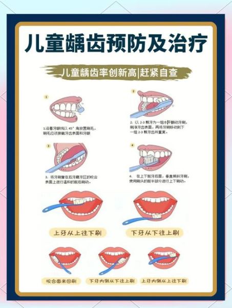 五岁宝宝蛀牙怎么办_如何预防五岁儿童龋齿