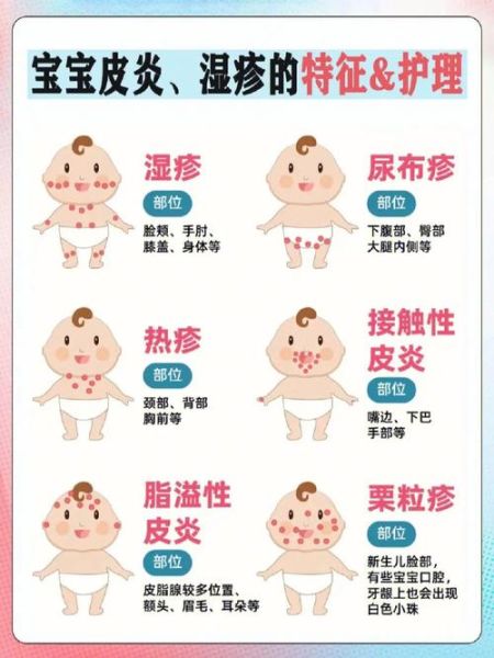 宝宝身上痒怎么办_宝宝皮肤痒的原因