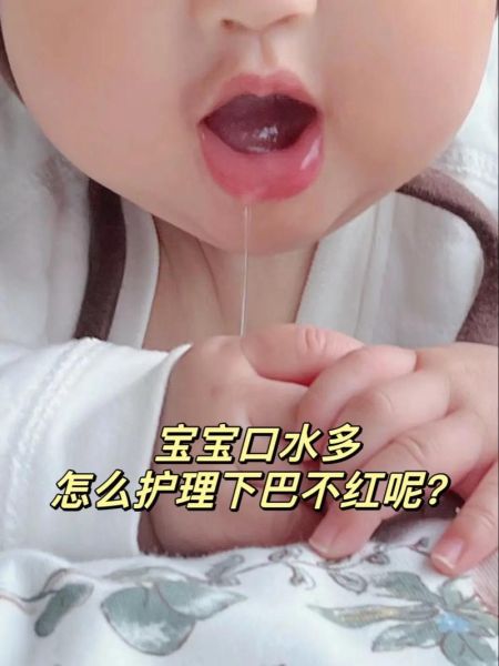 宝宝两周岁了还流口水怎么办_两岁宝宝流口水正常吗