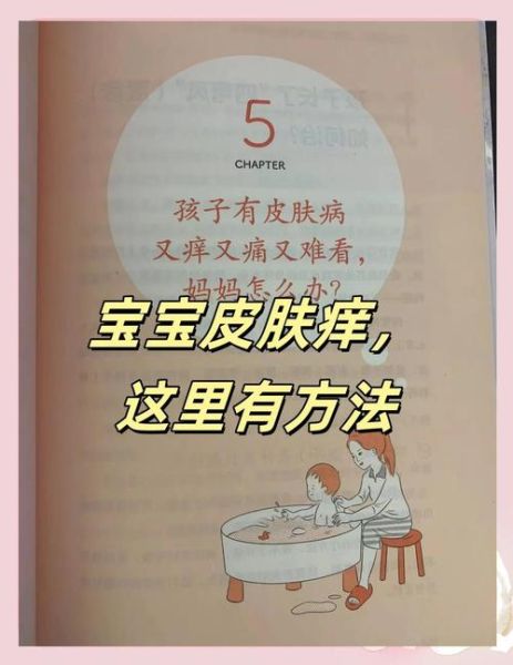 宝宝身上痒怎么办_宝宝皮肤痒的原因