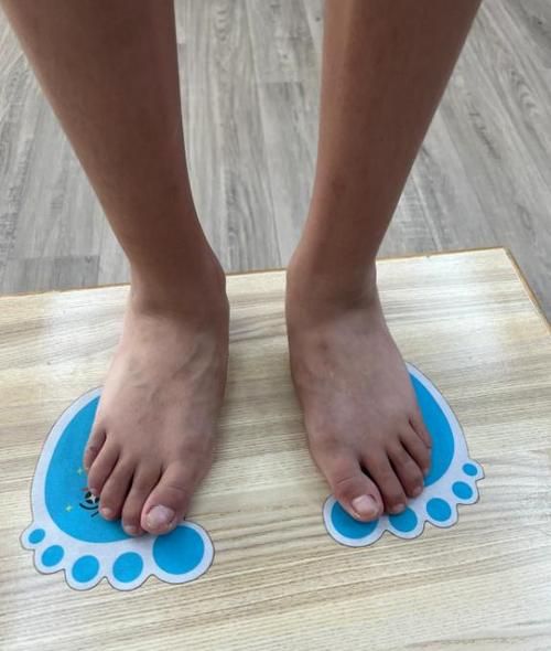 三个月宝宝脚往外撇正常吗_怎么矫正