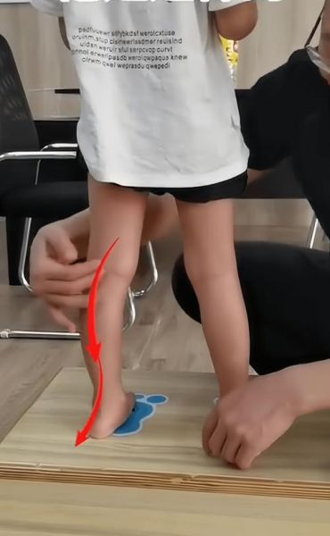 三个月宝宝脚往外撇正常吗_怎么矫正