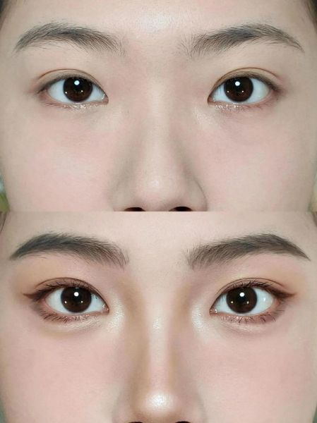 鼻子类型图解_塌鼻梁怎么改善