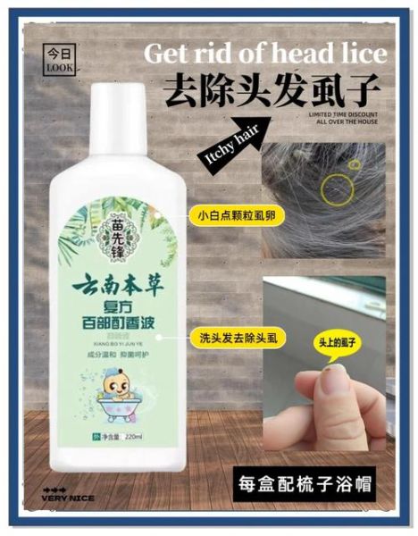 梦到头上长虱子是什么意思_头上长虱子梦境解析