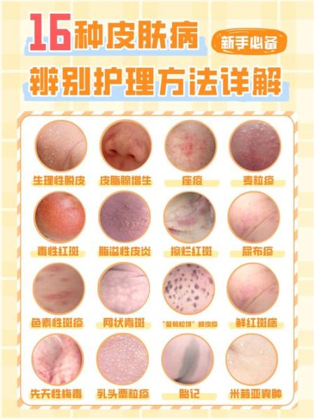皮肤图片大全_如何辨别常见皮肤病
