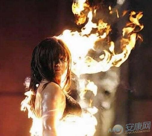梦到被火烧伤是什么意思_梦到被火烧伤预示什么