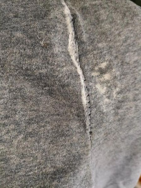 梦到衣服破了是什么意思_衣服破了预示什么