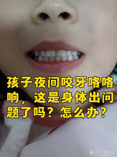 1岁宝宝白天咬牙咯咯响_是不是缺微量元素