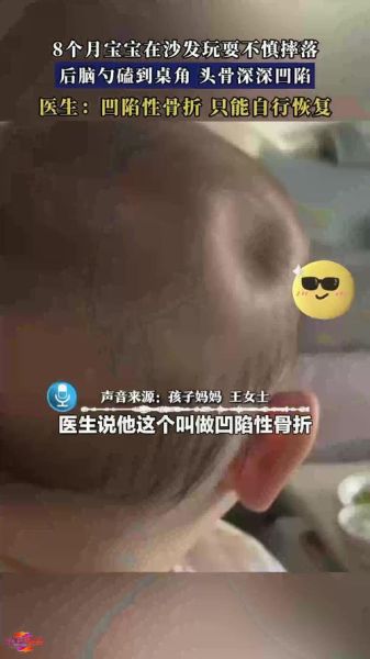 一岁宝宝磕到后脑勺怎么办_会不会脑震荡