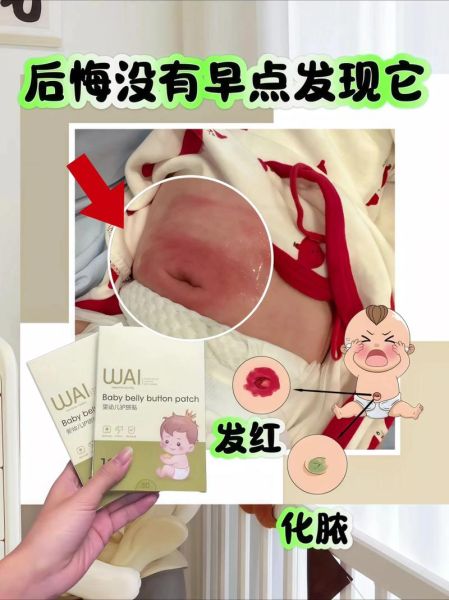 宝宝脐带出血怎么回事_新生儿脐部护理