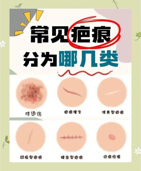 伤痕图片大全_如何分辨新旧伤疤